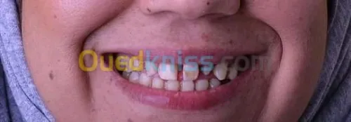 Prothesiste/مركب اسنان