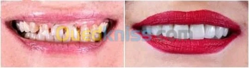 Prothesiste/مركب اسنان