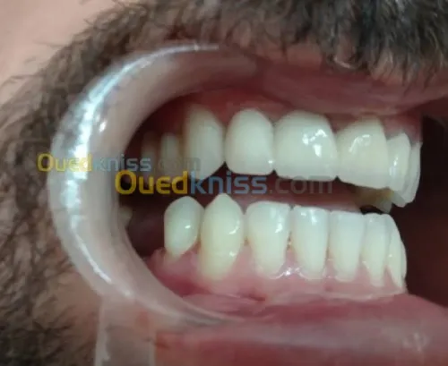 Prothesiste/مركب اسنان