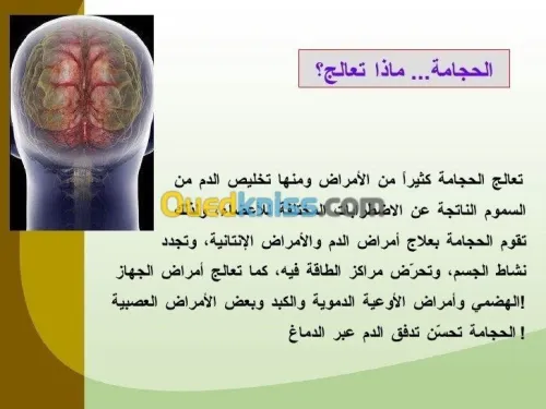 Hidjama (عند طبيب مختص) 