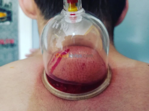 Kinésithérapeute/ hijama à domicile