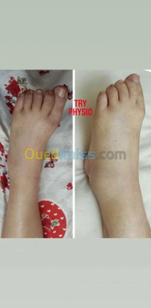 Kinésithérapeute/ hijama à domicile