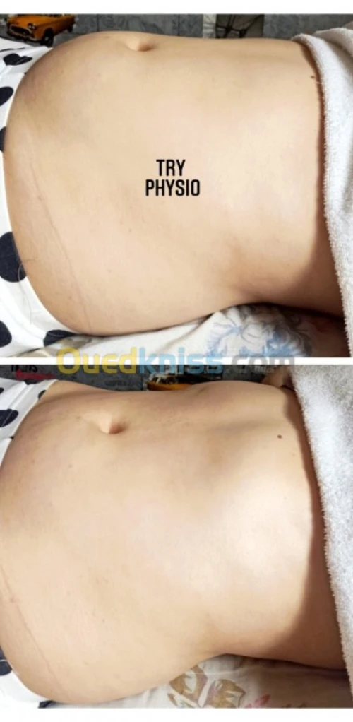 Kinésithérapeute/ hijama à domicile