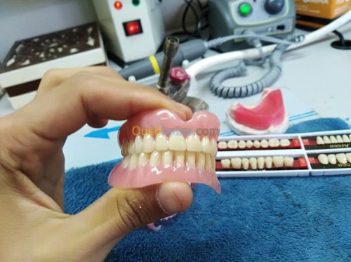 Prothèse dentaire amovible 