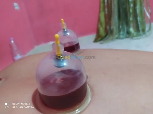 حجامة العلاجية و الوقائية  Cupping the