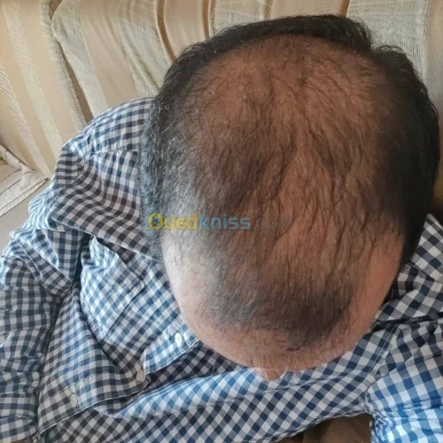 o2 nature traitement pour cheveux