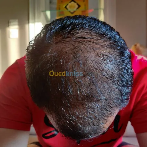 o2 nature traitement pour cheveux