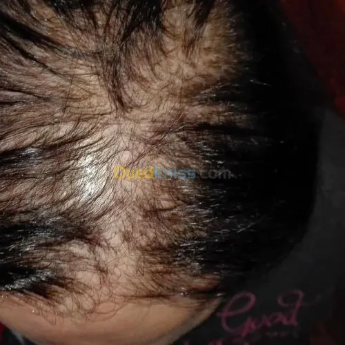 o2 nature traitement pour cheveux