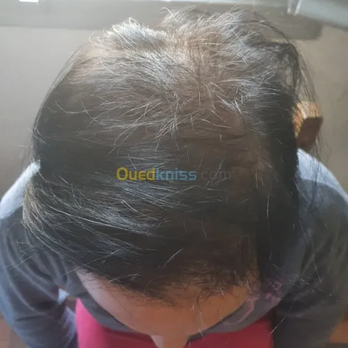o2 nature traitement pour cheveux