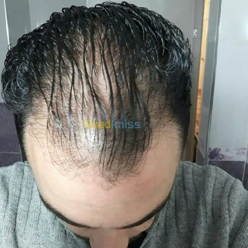 o2 nature traitement pour cheveux