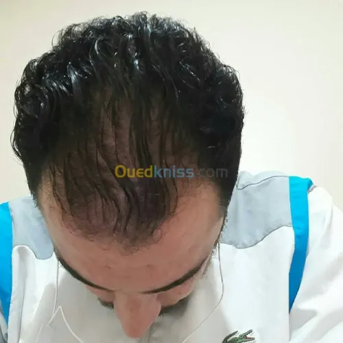 o2 nature traitement pour cheveux