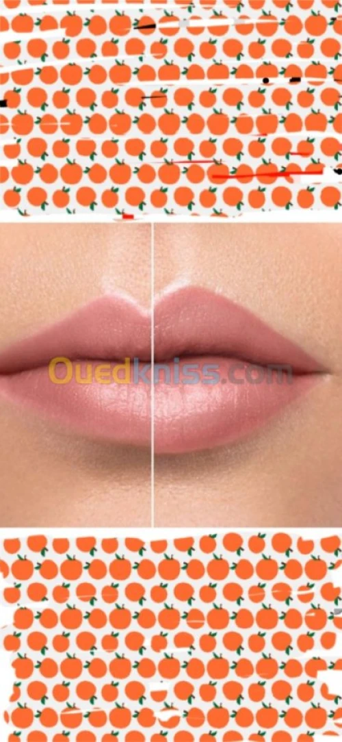  Botox filer microneedling et mesother