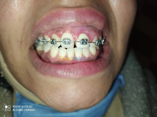 soins dentaire