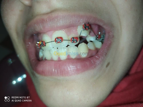 soins dentaire