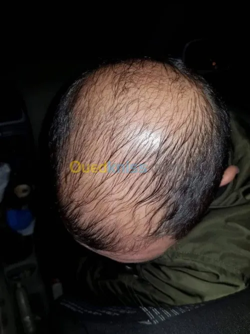 منتوج طبيعي مستورد من المغرب لتقويةالش
