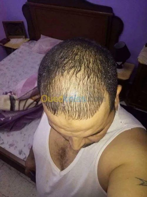 منتوج طبيعي مستورد من المغرب لتقويةالش