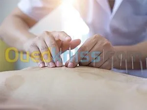 الحجامة الطبية نساء ورجال واطفال