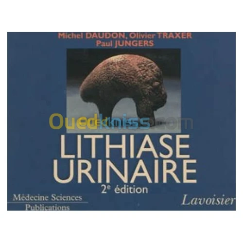 Lithiase urinaire