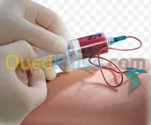 Prélèvement sanguin.Test anti génique