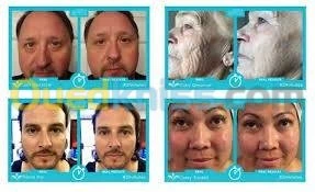 Anti âge santé et beauté