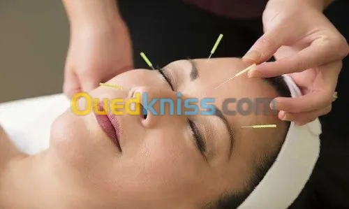 Acupuncture_ Dr khamchane Linda