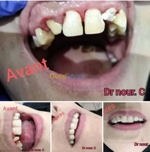 Dentiste طب وجراحة الاسنان
