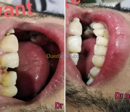 Dentiste طب وجراحة الاسنان