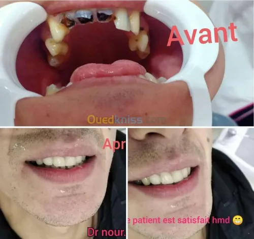 Dentiste طب وجراحة الاسنان