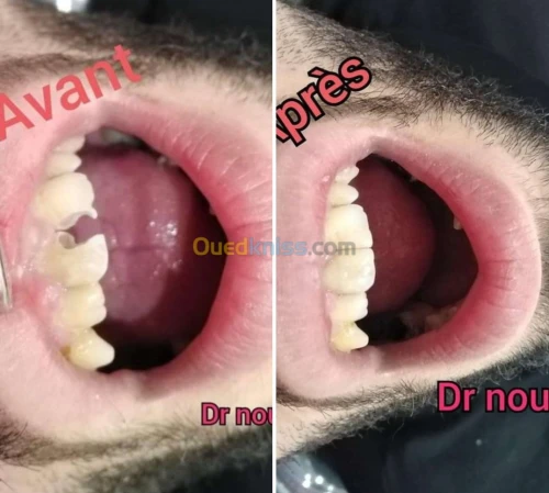 Dentiste طب وجراحة الاسنان