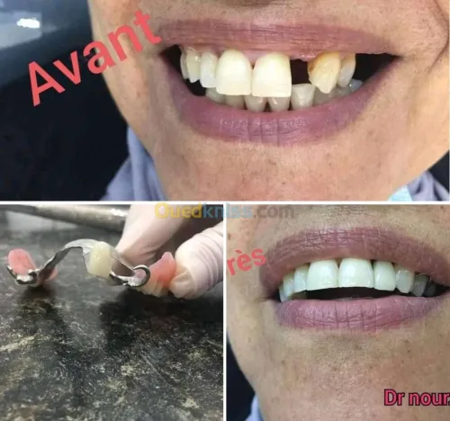 Dentiste طب وجراحة الاسنان