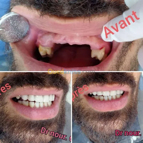 Dentiste طب وجراحة الاسنان