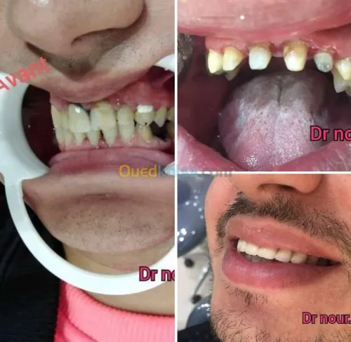 Dentiste طب وجراحة الاسنان
