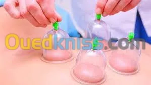 hijama حجامة