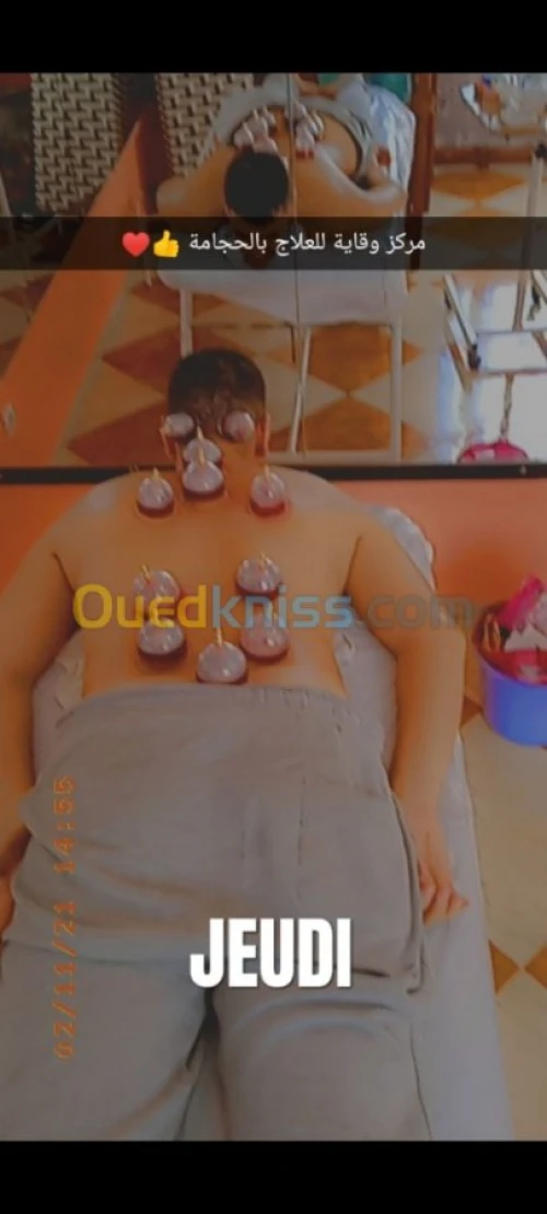 حجامة بجميع انواعها