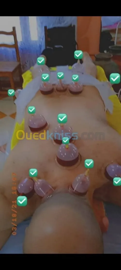 حجامة بجميع انواعها
