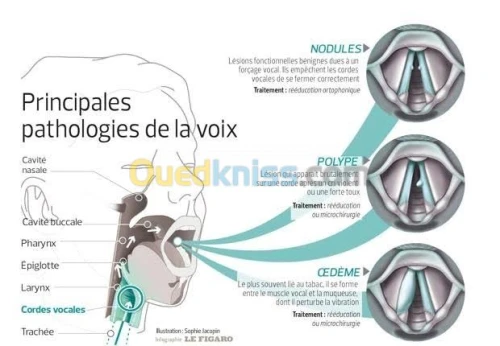 Orthophoniste a domicile