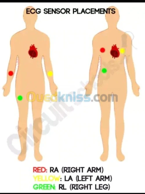 module Fréquence Cardiaque ECG arduino