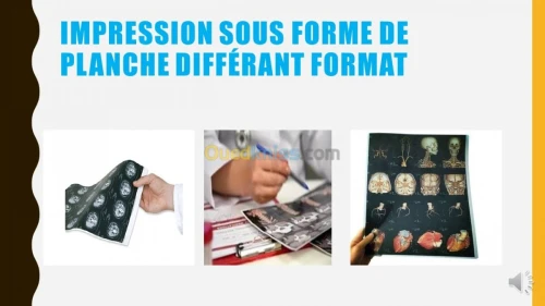 Print  Impression Papier Radiologie