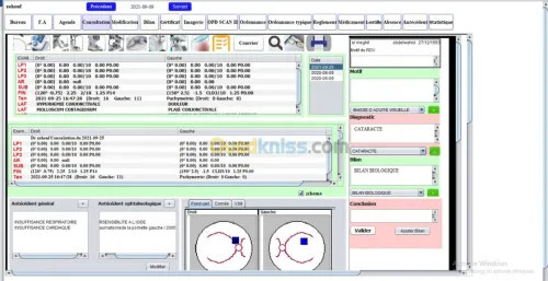 Vision ophtalmologie