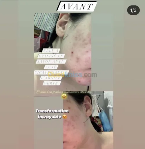 Bio.Touch