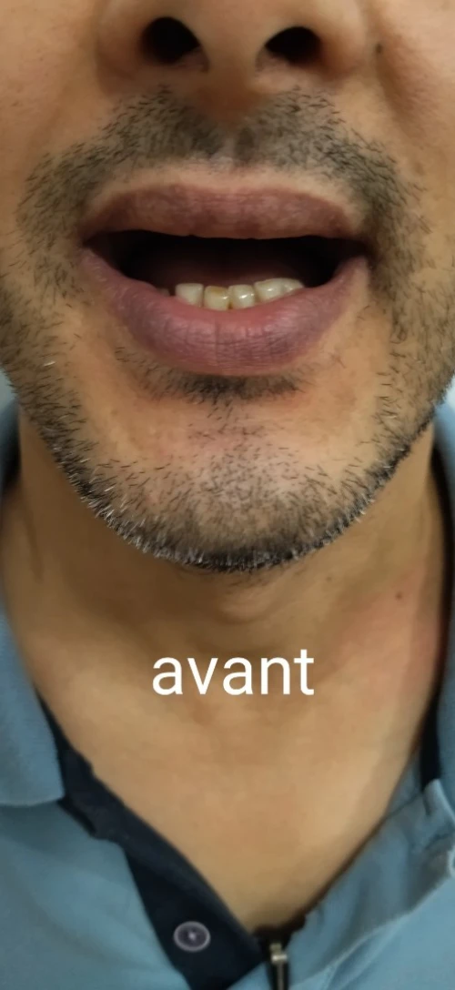 Prothésiste dentaire