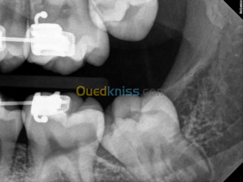 Equipements d'imageries medical