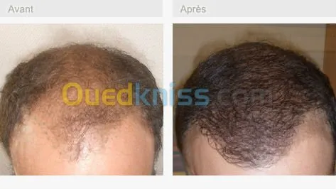 Services médicaux en Tunisie 