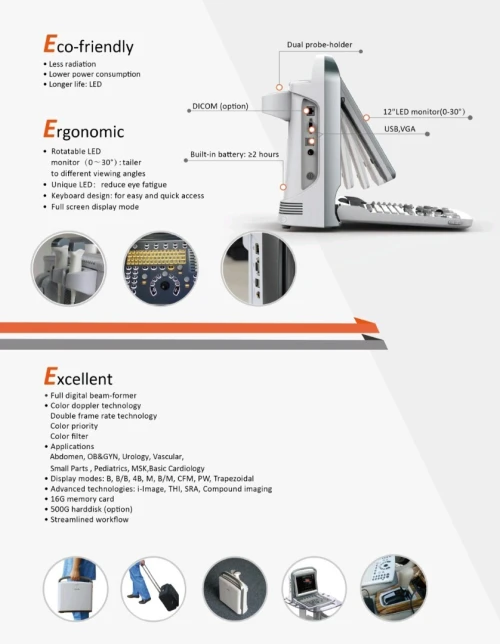 Échographie CHISON ECO 5