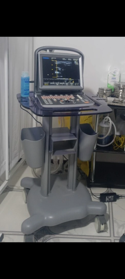 Échographie CHISON ECO 5