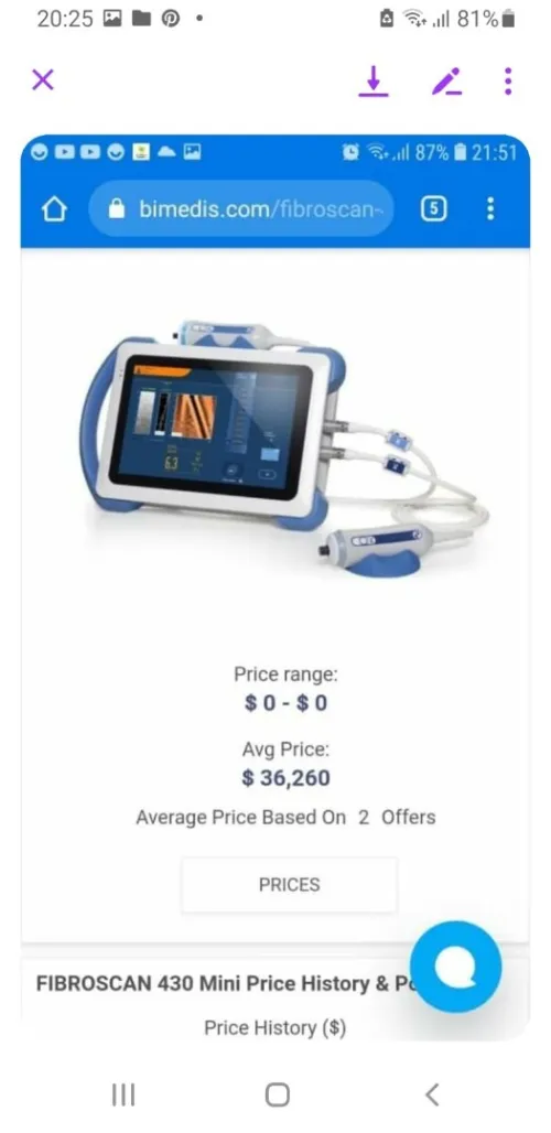 Fibroscan 430 mini d'echosen