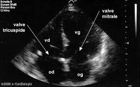 ECHOGRAPHIE CARDIAQUE A DOMICILE