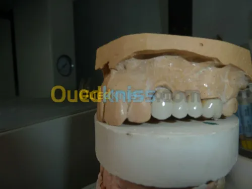 prothese dentaire, soins, odf,
