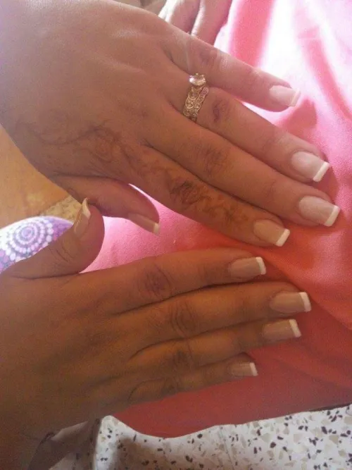 ONGLERIE
