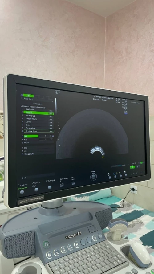 Echographie voluson S6